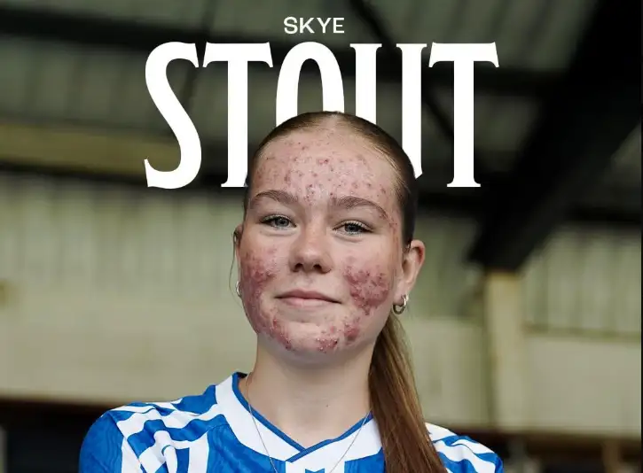 The 16-year-old talent became the target of online trolls—but fans have shown their support