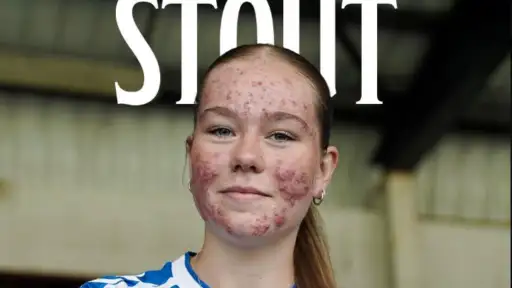 The 16-year-old talent became the target of online trolls—but fans have shown their support