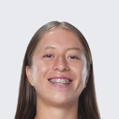 Itzel Muñoz